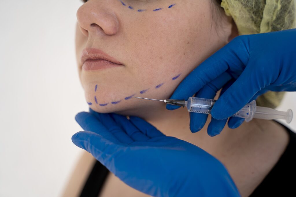 1Close-up of a woman receiving a facial injection treatment with marked guidelines, illustrating dermal fillers versus PDO thread lift procedures in a clinical setting.