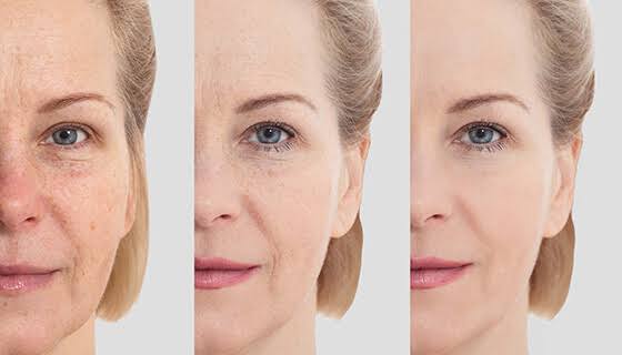 Face Rejuvenation Near Me
